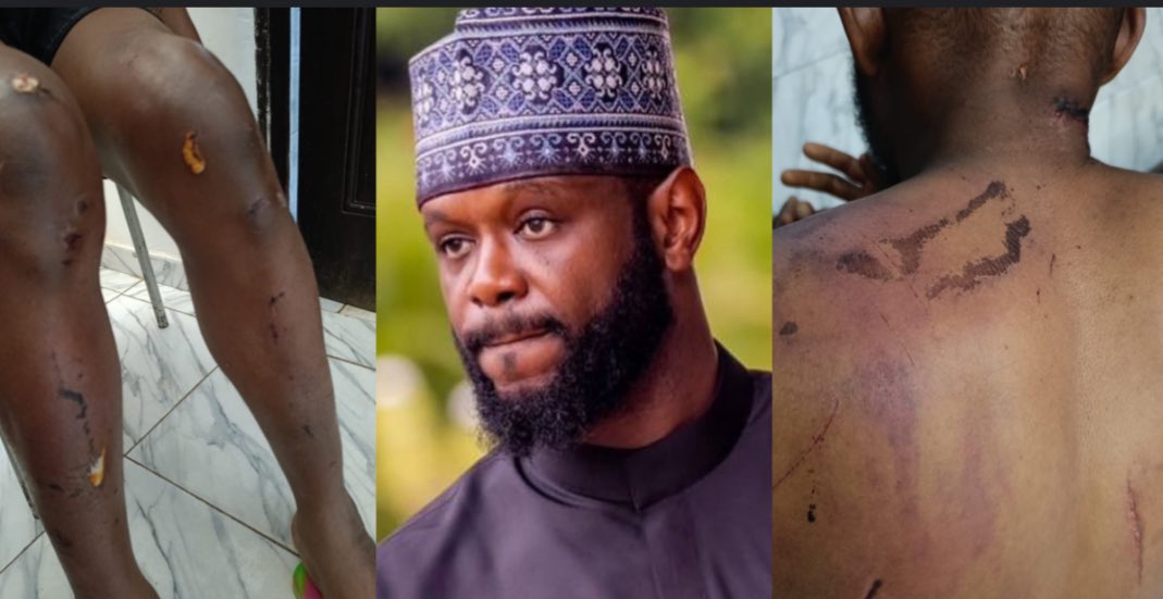 SaharaReporters's tweet image. BREAKING: Seyi Tinubu-Linked Thugs Brutalise NANS President, Disrupt Abuja Inauguration, Attack Ex-Governors Shekarau, Wada | Sahara Reporters bit.ly/4iDA9ck