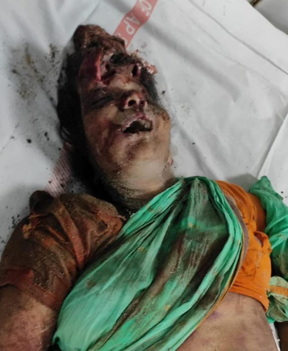 సింహాచలం ఘటనలో మృతిచెందిన వారిలో 4 గురు నగరాల సామాజిక వర్గానికి చెందినవారు ఉన్నారని తెలిసి చింతిస్తున్నాం ఇట్లు నగరాల సంక్షేమ సంఘం విజయవాడ. <a href="/nagaralu/">naga ralu</a> 

సింహాచలం ఘటన లో మరణించిన వారి కుటుంబాలకు కూటమి ప్రభుత్వం కోటి రూపాయల ఎక్స్ గ్రేషియా, ప్రభుత్వ ఉద్యోగం మరియు సొంత ఇల్లు