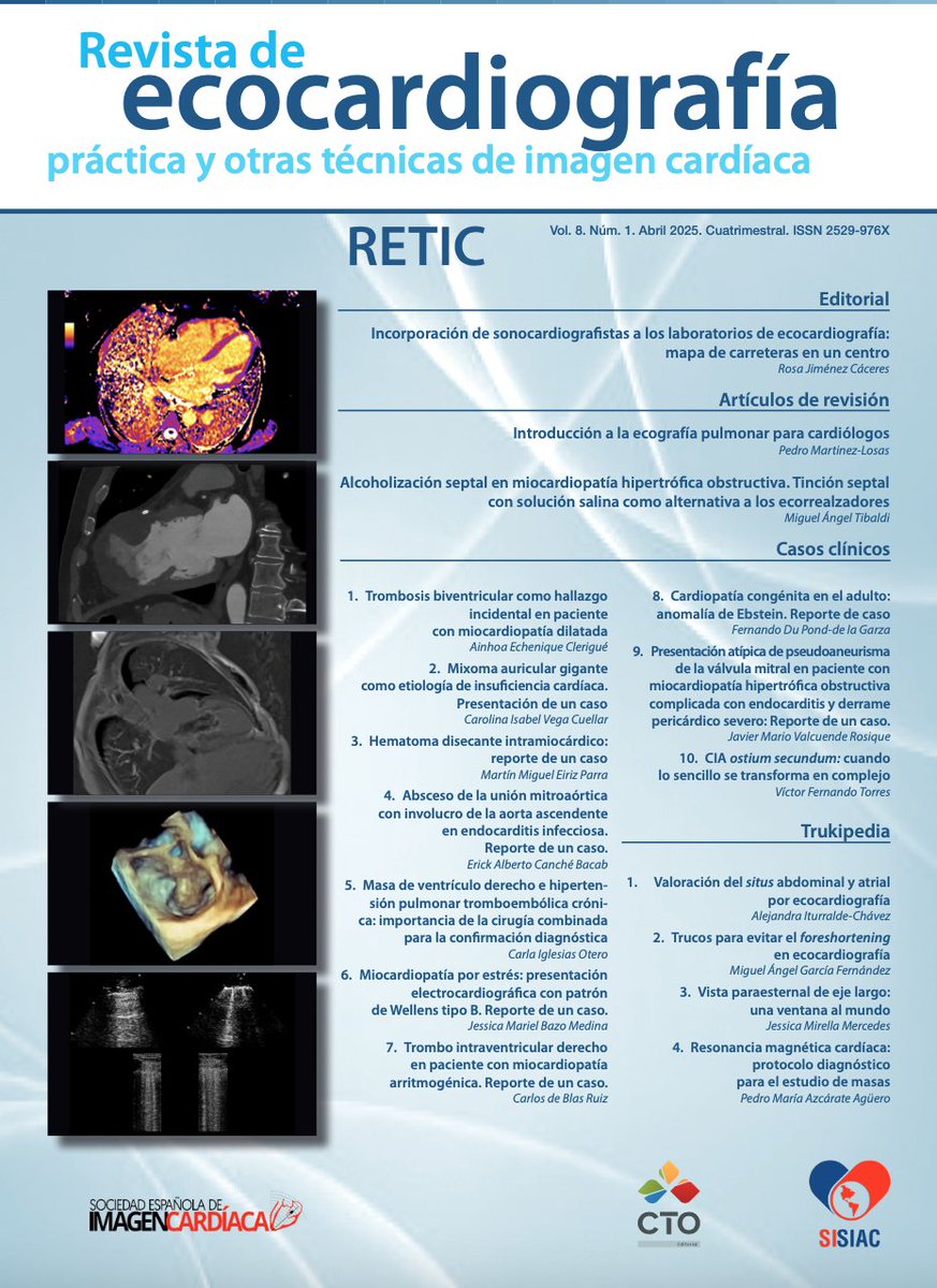 RevistaRetic (@revistaretic) on Twitter photo Extra, extra el nuevo número de RETIC ya esta disponible. ¿Te lo vas a perder?
imagenretic.org/RevEcocarPract…
<a href="/MAecocardio/">MA Garcia Fernandez</a> <a href="/josejgdnews/">Jose Juan Gomez</a> <a href="/CardioCecconi/">Alberto Cecconi</a> <a href="/Azcarate_Cardio/">Doctor Pedro Azcárate</a> <a href="/chileanestesia/">Editora Revista Chilena de Anestesia</a> <a href="/SISIACOficial/">SISIAC</a> <a href="/almasthela/">Alma Sthela Arrioja, MD</a> <a href="/rafavidalperez/">rafavidalperez</a> <a href="/GBastarrika/">Gorka Bastarrika</a> <a href="/Fcalvoiglesias/">Francisco Calvo</a> Extra, extra el nuevo número de RETIC ya esta disponible. ¿Te lo vas a perder?
imagenretic.org/RevEcocarPract…
<a href="/MAecocardio/">MA Garcia Fernandez</a> <a href="/josejgdnews/">Jose Juan Gomez</a> <a href="/CardioCecconi/">Alberto Cecconi</a> <a href="/Azcarate_Cardio/">Doctor Pedro Azcárate</a> <a href="/chileanestesia/">Editora Revista Chilena de Anestesia</a> <a href="/SISIACOficial/">SISIAC</a> <a href="/almasthela/">Alma Sthela Arrioja, MD</a> <a href="/rafavidalperez/">rafavidalperez</a> <a href="/GBastarrika/">Gorka Bastarrika</a> <a href="/Fcalvoiglesias/">Francisco Calvo</a>