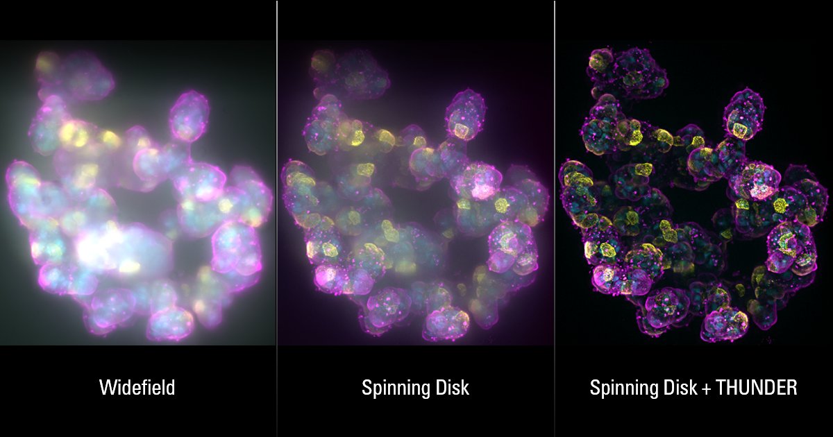 🔬 Struggling to quickly image large #3Dsamples &amp; get clear images? Say hello to the new THUNDER Imager Cell Spinning Disk! Combining fast versatile #SpinningDisk w/ THUNDER for enhanced contrast &amp; resolution gives more convincing data. See for yourself 👉 fcld.ly/f0my9v8