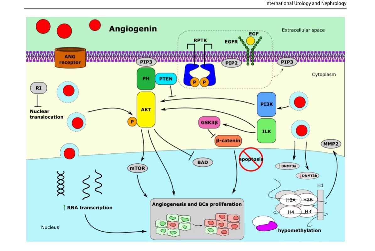 Ilaha Isali (@ilahaisali) on Twitter photo So proud of <a href="/Thomas_R_Wong/">Thomas Wong</a> for his first publication! .Check out our study exploring both the therapeutic and diagnostic role of angiogenin in #bladdercancer.
The link here 🔽🔽🔽 <a href="/WCMUrology/">Weill Cornell Medicine Urology</a>
pubmed.ncbi.nlm.nih.gov/40259145/ So proud of <a href="/Thomas_R_Wong/">Thomas Wong</a> for his first publication! .Check out our study exploring both the therapeutic and diagnostic role of angiogenin in #bladdercancer.
The link here 🔽🔽🔽 <a href="/WCMUrology/">Weill Cornell Medicine Urology</a>
pubmed.ncbi.nlm.nih.gov/40259145/