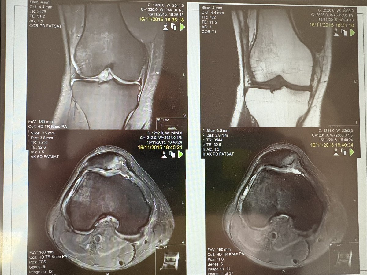 MACP (@physiomacp) on Twitter photo Discussing patient cases using a personalised care approach incorporating imaging with <a href="/jessgent78/">Jessica Gent</a> on her knee imaging course today. Great participant involvement ☀️ Discussing patient cases using a personalised care approach incorporating imaging with <a href="/jessgent78/">Jessica Gent</a> on her knee imaging course today. Great participant involvement ☀️