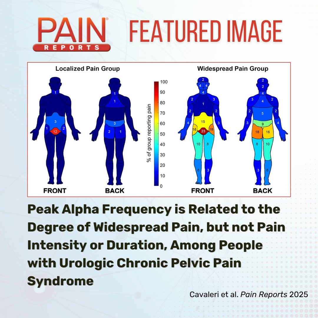 Cavaleri et al. find that widespread pain, reflecting central sensitization, is associated with lower peak alpha frequency when compared with localized pain in people with chronic pelvic pain syndrome. Learn more in #PainReports bit.ly/44BvT9Z