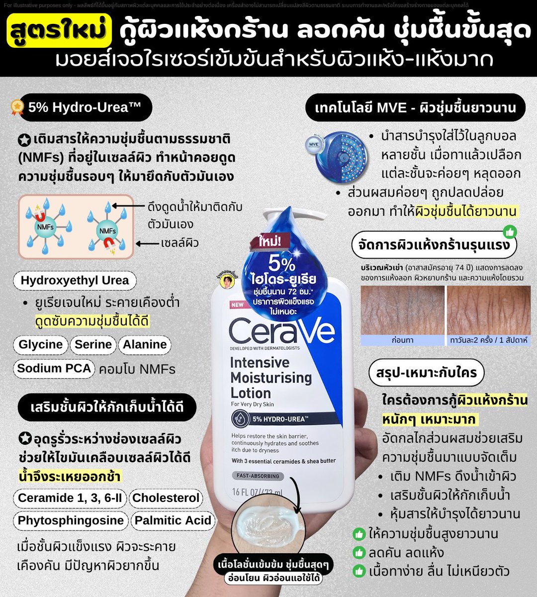 PaoRangThong's tweet photo. ผิวแห้งขั้นสุด สูตรใหม่นี้เอาอยู่ 100/10

มี Hydro-Urea ที่เป็นสาร NMF ทำงานเหมือนแม่เหล็กคอยดูดน้ำเข้าเซลล์ผิวมาเพิ่ม ซึ่งวิจัยพบว่าคนที่ผิวแห้งมากๆ มักจะขาดสารกลุ่มนี้ ทาอะไรไปผิวจึงชุ่มชื้นไม่พอ

ใครผิวแห้งจัดๆ มา CeraVe สูตรใหม่ได้เลย กู้ผิวแห้งขั้นสุด แถมลดคัน ไม่แพง เติมน้ำ NMFs เสริมชั้นผิวครบ👇