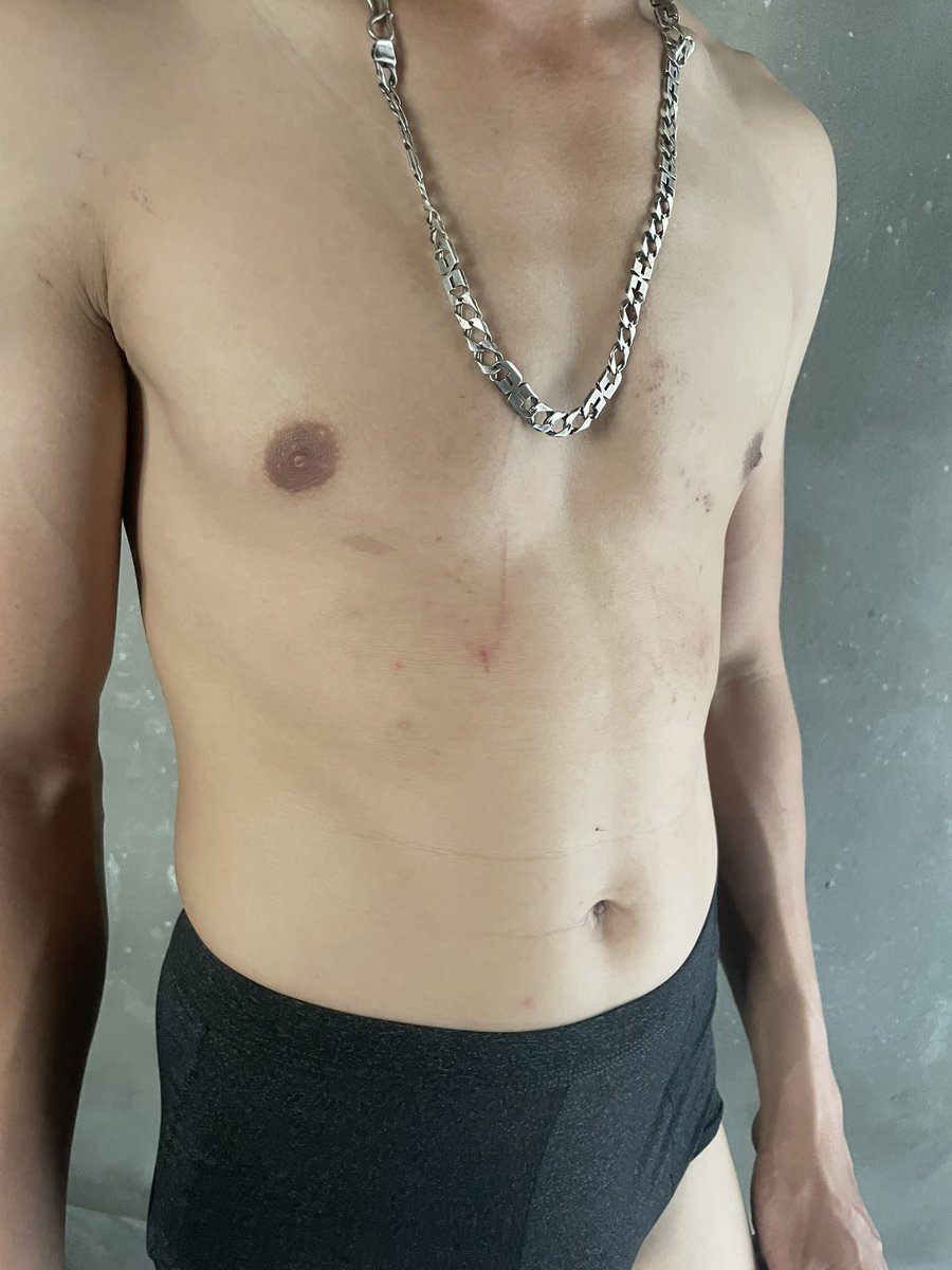 Hà Nội buồn quá, nhớ anh bạn cùng giường ghê😢