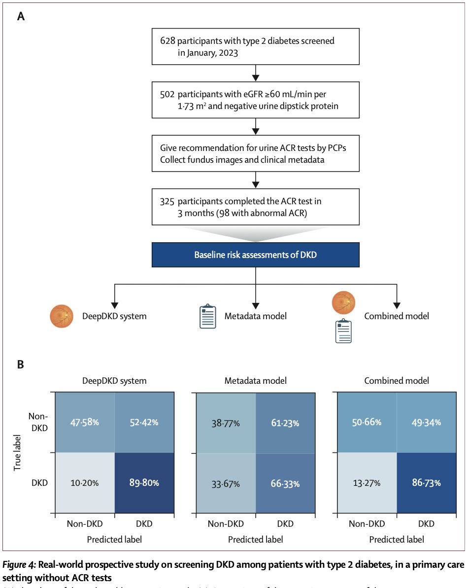 Eric Topol (@erictopol) on Twitter photo How not to do a kidney biopsy to diagnose diabetic nephropathy?
A.I. of the retina!
thelancet.com/journals/landi⦠<a href="/LancetDigitalH/">The Lancet Digital Health</a> How not to do a kidney biopsy to diagnose diabetic nephropathy?
A.I. of the retina!
thelancet.com/journals/landi⦠<a href="/LancetDigitalH/">The Lancet Digital Health</a>