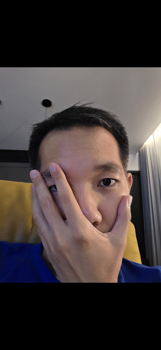 spin9's tweet image. AI บนมือถือตอนนี้นี่ Samsung โหดจัด เดินเกมดี อัพย้อนหลังให้เครื่องเก่า 2-3 ปี รองรับฟีเจอร์ใหม่ได้เกือบหมด S23 ก็ยังใช้ดี อัพ One UI 7 ได้ 

ลอง Generative Edit ลบมือที่ปิดหน้าครึ่งนึงปิดตาข้างนึง ยังเจนหน้าออกมาเหมือนตัวจริง โหดเกินนนน