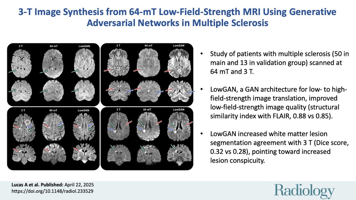 Penn Medicine CSO (@pennmedcso) on Twitter photo New research from Joel Stein (<a href="/PennRadiology/">Penn Radiology</a>) shows generative #AI can help low-field MRI detect multiple sclerosis lesions with the same efficacy as standard scans—opening doors to more accessible MS care pubs.rsna.org/doi/10.1148/ra… New research from Joel Stein (<a href="/PennRadiology/">Penn Radiology</a>) shows generative #AI can help low-field MRI detect multiple sclerosis lesions with the same efficacy as standard scans—opening doors to more accessible MS care pubs.rsna.org/doi/10.1148/ra…