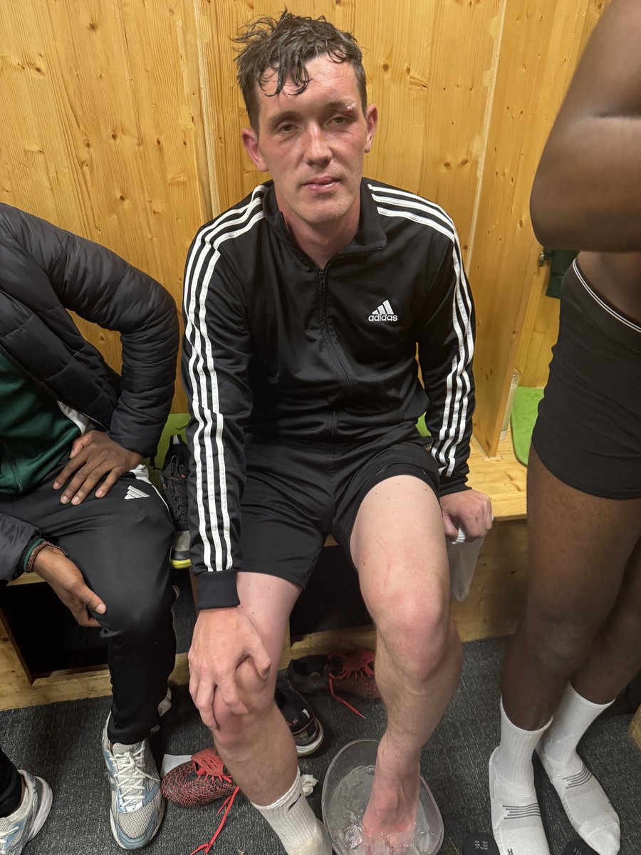 Appreciation tweet for Connor Dymond after last night. 

Went to absolute battle for the team, defended with his body, went home with several injuries having scored an absolute belter to send us on our way!

Top lad.