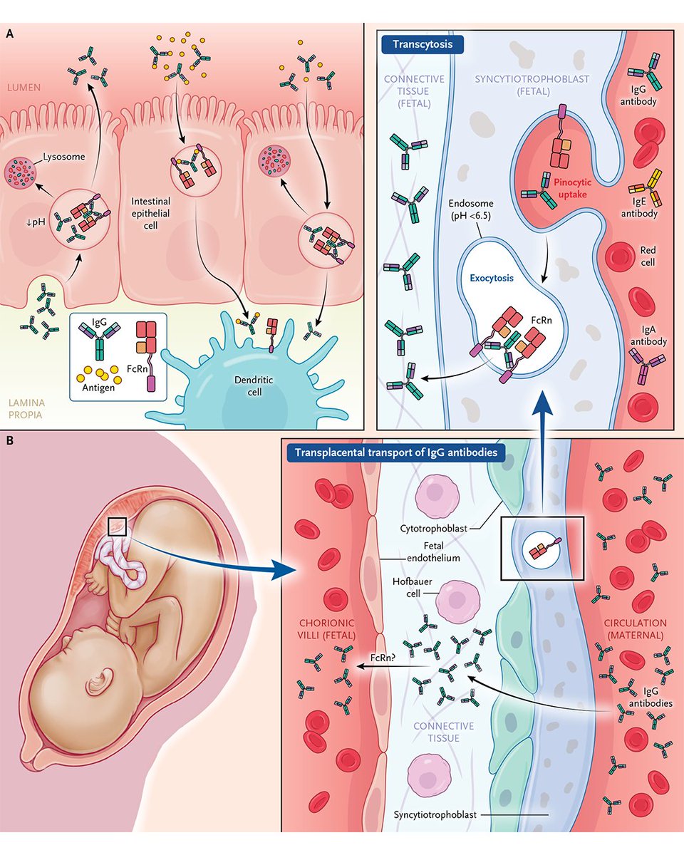 Review Article: Neonatal Fc Receptor — Biology and Therapeutics nej.md/42gEZYk 

#Gastroenterology #OBGYN