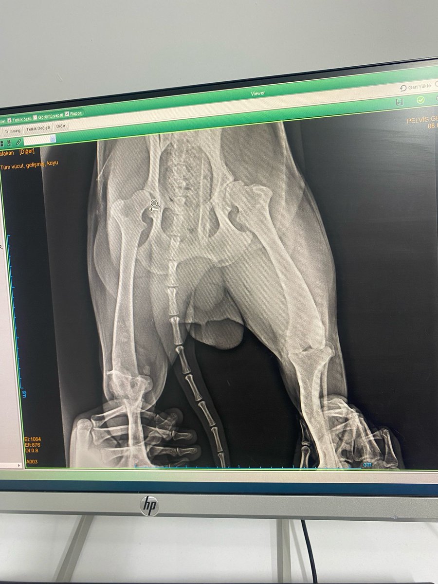 Afakan engelli ayağını ısırmaya başlamış. Ampute mi olacak ameliyat mı olacak bilmiyorum😓 Fakültedeki hoca dan yorum bekliyorum.Bu ameliyatları sadece onlar yapıyor ve peşin ödemeli..
Vet.hekiminize röntgenleri gösterip yorum rica edermisinz🙏 hatayda imkanlar çok kısıtlı lütfen