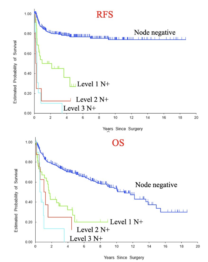 UroToday.com (@urotoday) on Twitter photo Level of nodal metastasis in patients undergoing radical cystectomy and lymphadenectomy for muscle-invasive #UrothelialCancer: Is there still a role of extended lymphadenectomy in the post-S1011 era? Presented by <a href="/LeileiXiaUro/">Leilei Xia</a> <a href="/USC_Urology/">USC Urology</a>. #AUA25 written coverage by <a href="/val_saadat/">Val Saadat</a> Level of nodal metastasis in patients undergoing radical cystectomy and lymphadenectomy for muscle-invasive #UrothelialCancer: Is there still a role of extended lymphadenectomy in the post-S1011 era? Presented by <a href="/LeileiXiaUro/">Leilei Xia</a> <a href="/USC_Urology/">USC Urology</a>. #AUA25 written coverage by <a href="/val_saadat/">Val Saadat</a>