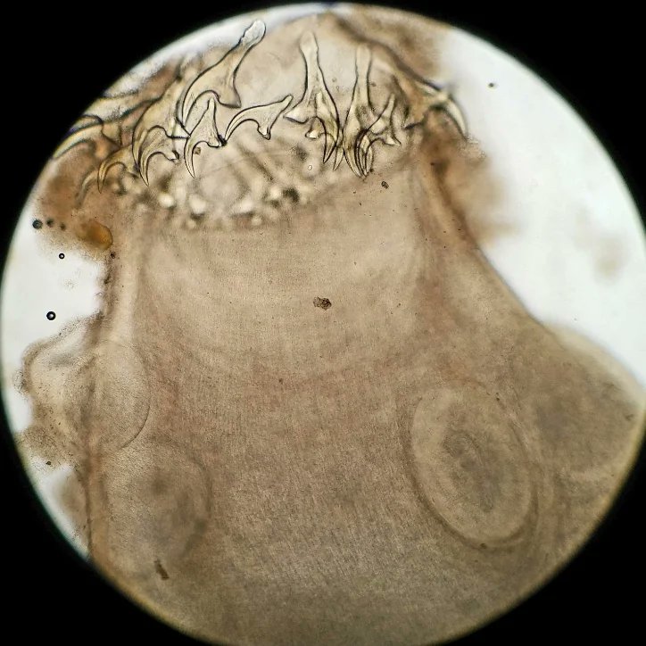 Scolex of a Taenia tapeworm. I found a very small tapeworm in a dog fecal sample. I put the worm on a microscope slide, put a few drops of saline on it, and pushed a coverslip onto it. Notice the rostellum, hooks, and suckers
#parasitology #vet #parasites #veterinary #vettech