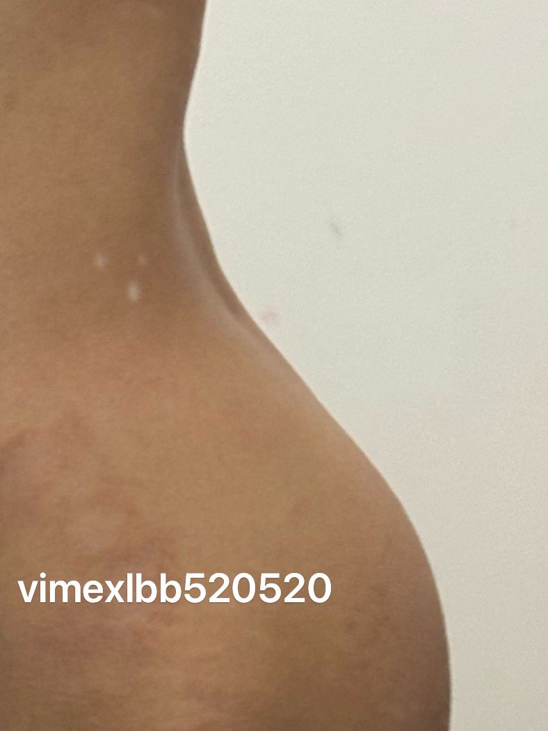 Vimex tweet media
