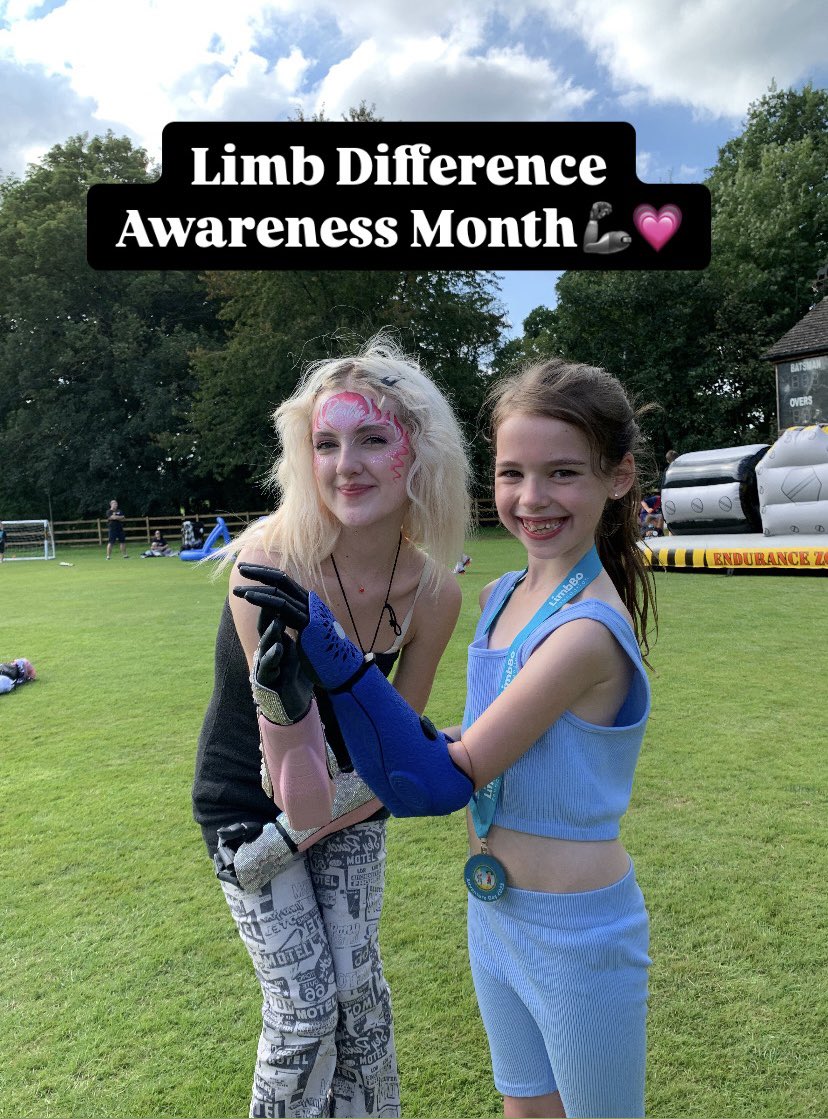 openbionics's tweet image. As #LimbDifferenceAwarenessMonth comes to a close, we want to spotlight and celebrate our amazing Hero Arm users who are consistently crushing the game.🦾💙
Let’s keep pushing for representation, accessibility, and innovation — all year round.💗🦾
#LDAM #Codesign #ThankYou