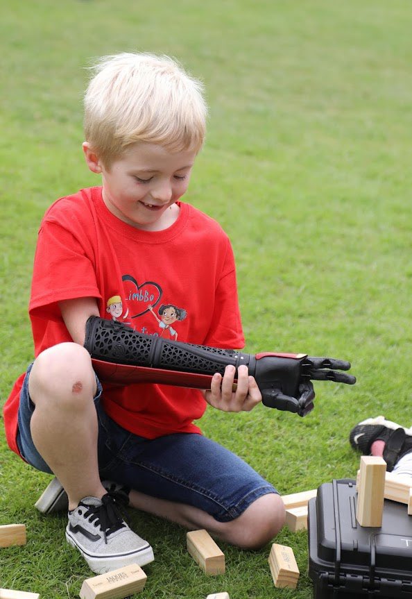 openbionics's tweet image. As #LimbDifferenceAwarenessMonth comes to a close, we want to spotlight and celebrate our amazing Hero Arm users who are consistently crushing the game.🦾💙
Let’s keep pushing for representation, accessibility, and innovation — all year round.💗🦾
#LDAM #Codesign #ThankYou