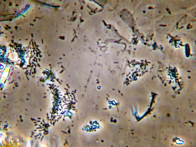 javiermfrico's tweet photo. ¿Quieres observar bacterias, bacilos, cocos y otros seres de mal vivir, vistos al #microscopio? Lo vas a flipar, visita mi #blog https://t.co/2yALjY11WV
#microscopy #ciencia #art #arte #fotografía #photographicart #lagacetadegea https://t.co/DrZgX0QZzr