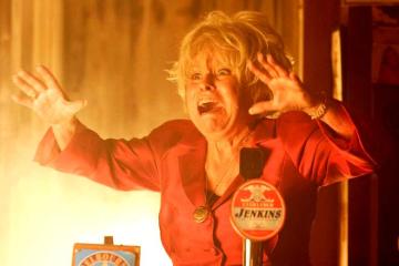 Accidentally burnt my arm with pasta sauce