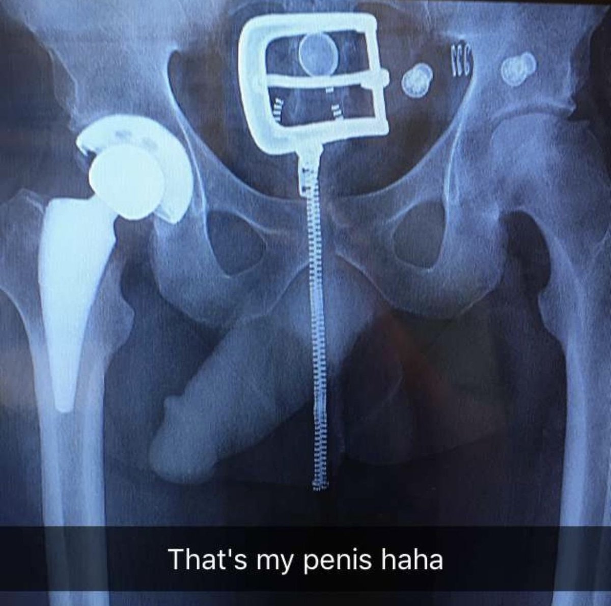 lordes album cover reminding me of this Reddit post lmao