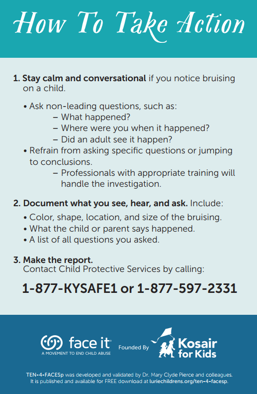 As National Child Abuse Prevention Month winds down, let's continue to raise awareness, support families &amp; work together to keep children safe. Help identify whether bruising on kids under 4 is more likely to be caused by abuse than accidental injury. <a href="/faceitabuse/">Face It® Movement</a> <a href="/KosairForKids/">Kosair for Kids</a>