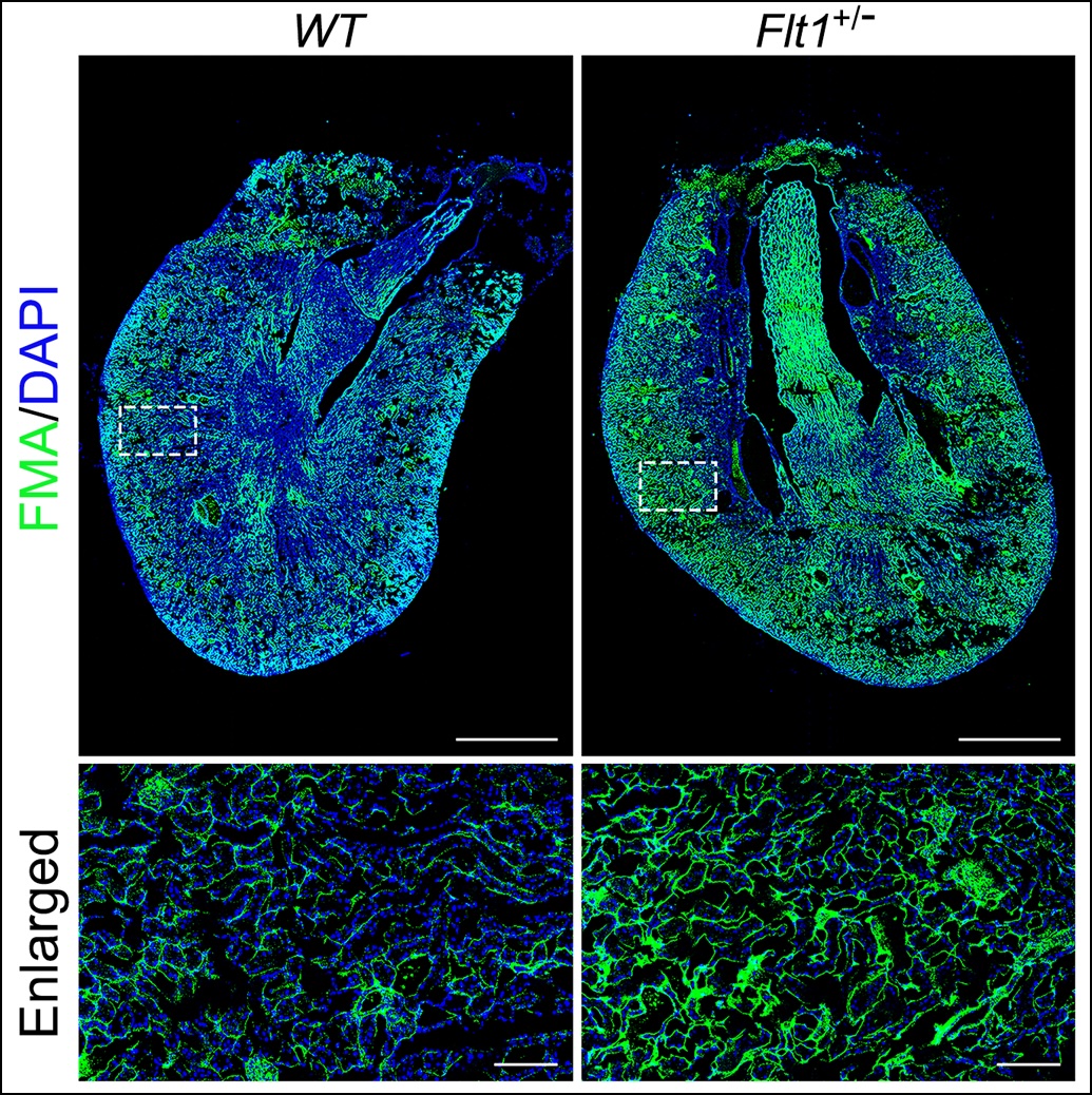 Pathological Society (@pathsoc) on Twitter photo The latest Editor’s Choice article in #TheJournalOfPathology is 'Contribution of alterations in peritubular capillary density and microcirculation to the progression of tubular injury and kidney fibrosis' Z Rhen et al shorturl.at/SGwR4
The full list: …thsocjournals.onlinelibrary.wiley.com/doi/toc/10.100… The latest Editor’s Choice article in #TheJournalOfPathology is 'Contribution of alterations in peritubular capillary density and microcirculation to the progression of tubular injury and kidney fibrosis' Z Rhen et al shorturl.at/SGwR4
The full list: …thsocjournals.onlinelibrary.wiley.com/doi/toc/10.100…