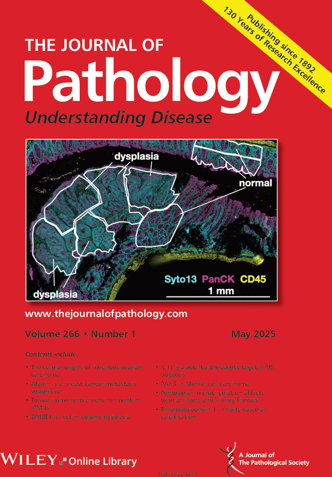 Pathological Society (@pathsoc) on Twitter photo The May 2025 issue of The Journal of Pathology is live! …thsocjournals.onlinelibrary.wiley.com/toc/10969896/2…
Cover image: 'Multiomic spatial atlas shows deleted in malignant brain tumors 1 (DMBT1) glycoprotein is lost in colonic dysplasia' EH Green et al.
…thsocjournals.onlinelibrary.wiley.com/doi/10.1002/pa… The May 2025 issue of The Journal of Pathology is live! …thsocjournals.onlinelibrary.wiley.com/toc/10969896/2…
Cover image: 'Multiomic spatial atlas shows deleted in malignant brain tumors 1 (DMBT1) glycoprotein is lost in colonic dysplasia' EH Green et al.
…thsocjournals.onlinelibrary.wiley.com/doi/10.1002/pa…