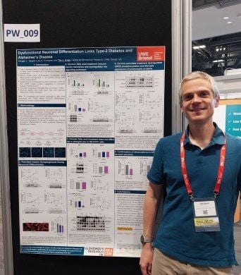 School of Applied Sciences (@uwe_soas) on Twitter photo <a href="/LACrompton80/">LUCY CROMPTON</a> <a href="/BritishNeuro/">British Neuroscience Association</a> Tim Craig presented a poster & talk entitled 'Dysfunctional neuronal differentiation links type-2 diabetes and Alzheimer's disease'. #BNA2025 #neuroscience #Alzheimers #Diabetes <a href="/LACrompton80/">LUCY CROMPTON</a> <a href="/BritishNeuro/">British Neuroscience Association</a> Tim Craig presented a poster & talk entitled 'Dysfunctional neuronal differentiation links type-2 diabetes and Alzheimer's disease'. #BNA2025 #neuroscience #Alzheimers #Diabetes
