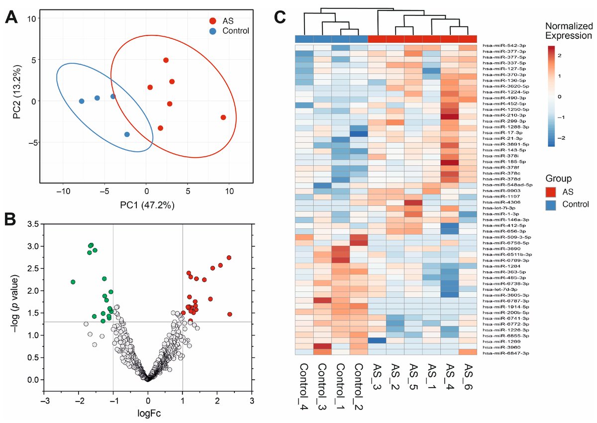 CardioTeca (@cardioteca) on Twitter photo ➡️ MicroRNAs como biomarcadores circulantes para el diagnóstico de estenosis aórtica en población geriátrica
⚕️ Comentario de la Autora: Mónica Ramos Sánchez
👀 cardioteca.com/cardiologia-cl…
<a href="/GermanECediel/">German E Cediel</a> ➡️ MicroRNAs como biomarcadores circulantes para el diagnóstico de estenosis aórtica en población geriátrica
⚕️ Comentario de la Autora: Mónica Ramos Sánchez
👀 cardioteca.com/cardiologia-cl…
<a href="/GermanECediel/">German E Cediel</a>