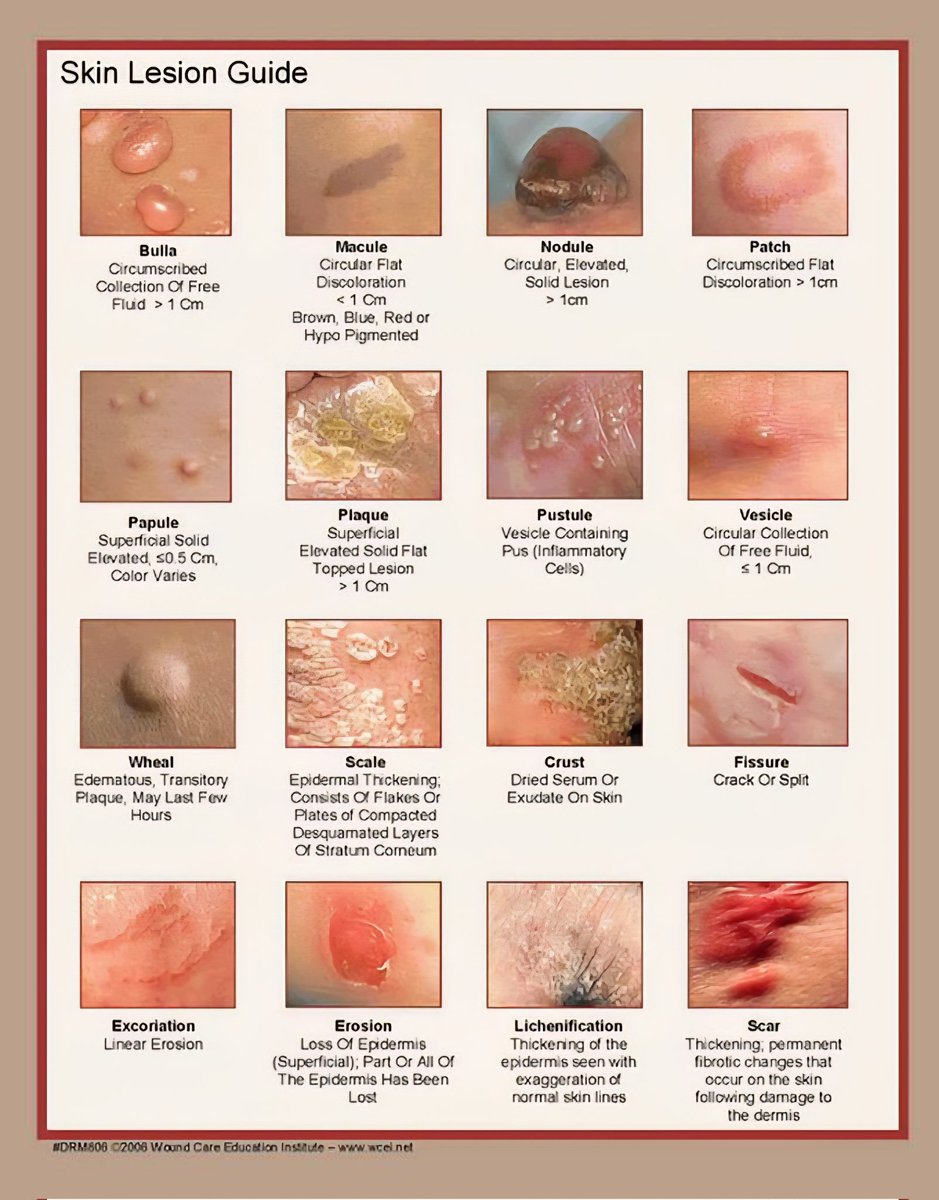 IMPORTANT SKIN LESIONS ✨

#neetpg2025