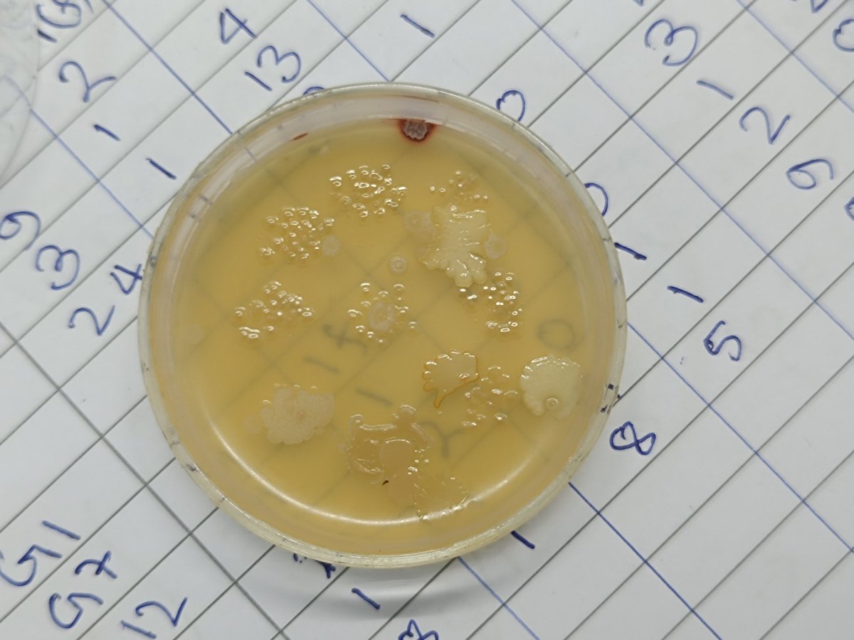 JishuHaldar2's tweet image. Spending my day in the lab, working on my final year project. Slow and steady progress—but it&apos;s happening! #PharmacyLife #LabDiaries #ResearchModeOn