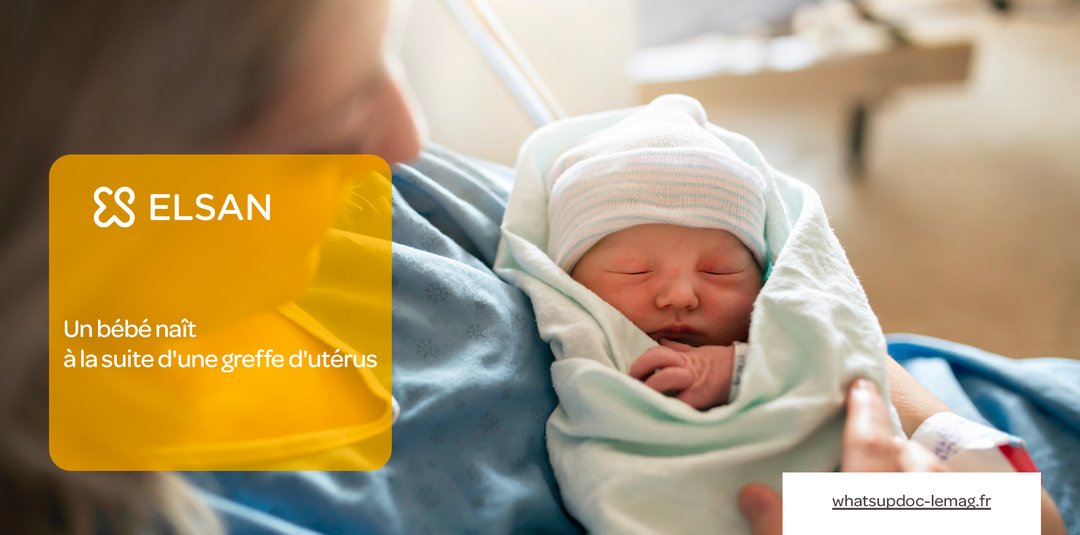 🇬🇧 Pour la première fois au Royaume-Uni, une femme née sans utérus a pu donner la vie à la suite d'une greffe réalisée en 2023, grâce à un don d’utérus de la part de sa sœur. Une avancée majeure dans la prise en charge de l’infertilité utérine.

👉 bit.ly/42rgtm8