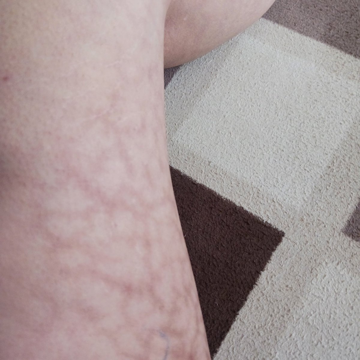 3o2FBc9JS97647's tweet image. なに何ナニ⁉️Nani,what?
#テクノロジー犯罪
加害が酷く成ってますが⁉️
世界中の被害者さん達は大丈夫⁉️
痛いよ～
What,what,Nani,what⁉️Nani,what?
#TechnologyCrime
The perpetration is getting worse?
Victims around the world are fine ?
#TargetedIndividuals
@TargetedJustice