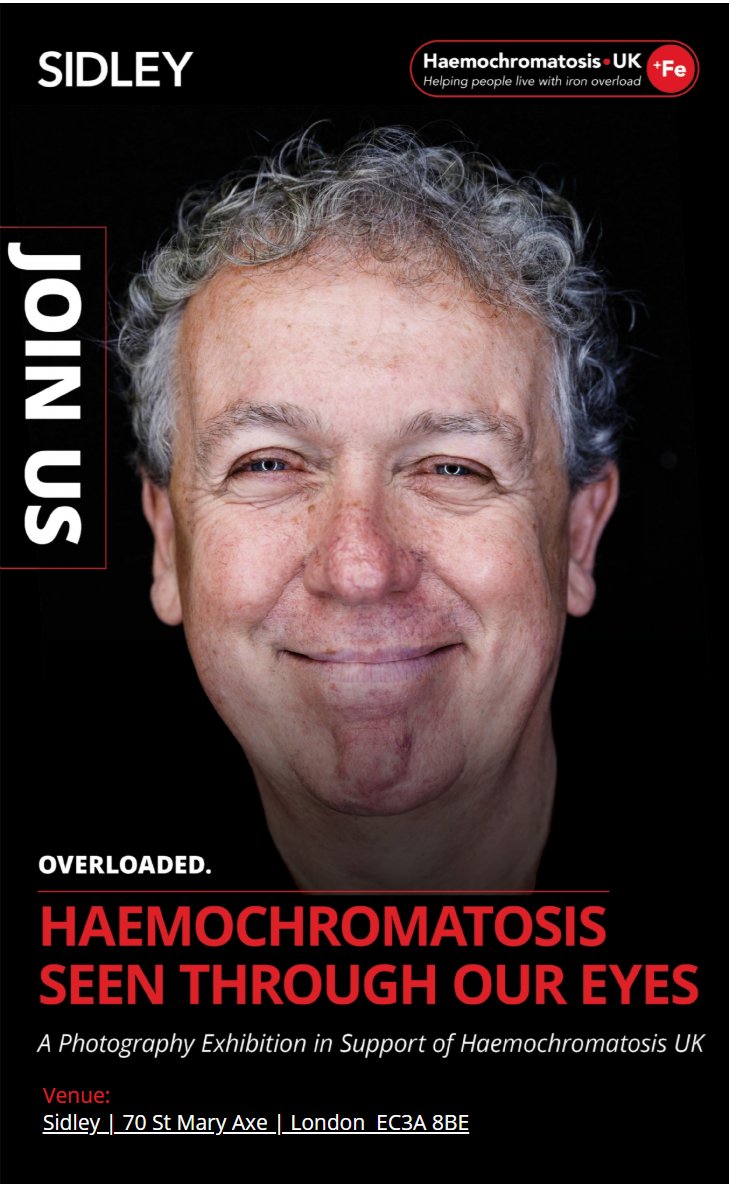 Haemochromatosis UK (@ironoverloaduk) on Twitter photo Open weekend for We Are Overloaded exhibition in City of London. FREE ENTRY.
📷 Saturday 17th & Sunday 18th May : 10am to 4pm (£free)
70 St Mary Axe - nearest tube Liverpool St/Aldgate
Generously supported by <a href="/SidleyLaw/">Sidley Austin LLP</a> & <a href="/easterncityldn/">Eastern City BID</a>
#WeAreOverloaded #haemochromatosis Open weekend for We Are Overloaded exhibition in City of London. FREE ENTRY.
📷 Saturday 17th & Sunday 18th May : 10am to 4pm (£free)
70 St Mary Axe - nearest tube Liverpool St/Aldgate
Generously supported by <a href="/SidleyLaw/">Sidley Austin LLP</a> & <a href="/easterncityldn/">Eastern City BID</a>
#WeAreOverloaded #haemochromatosis