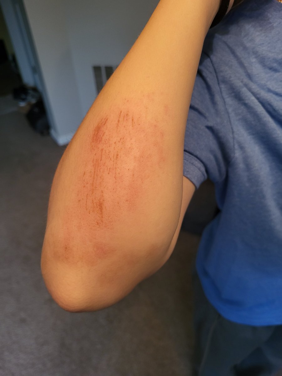 Brian Hurrle tweet media