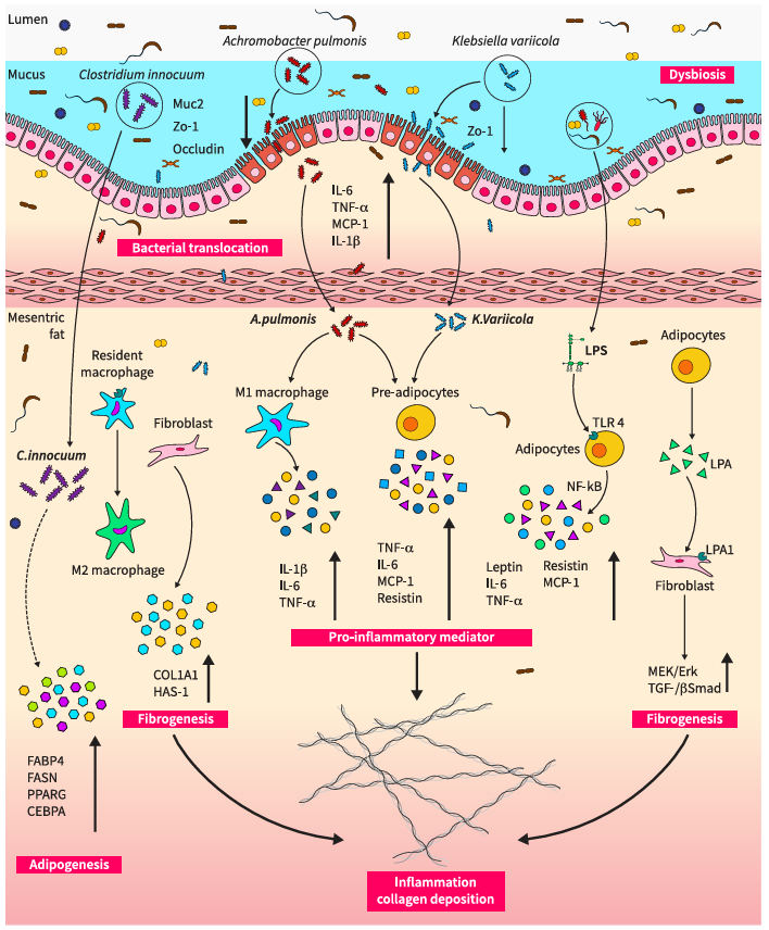 🔬Gut #Microbiota plays a key role in the development of intestinal fibrosis #CreepingFat in #Crohn’s disease.

Microbial species and their metabolites drive inflammation, fibroblast activation, ECM buildup &amp; mesenteric fat changes

📖 #OpenAccess 👉 bit.ly/4j3Sj7A