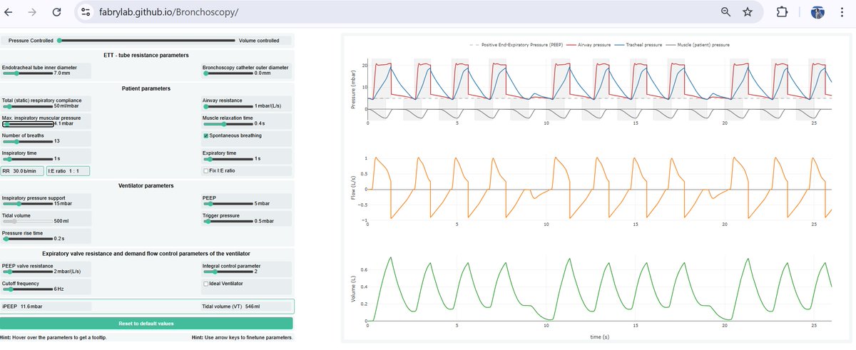 We developed a browser-based tool to predict ventilation impairments such as iPEEP buildup, hypoventilation, and desynchronization due to the tube resistance (also during bronchoscopy). Check it out: fabrylab.github.io/Bronchoscopy/