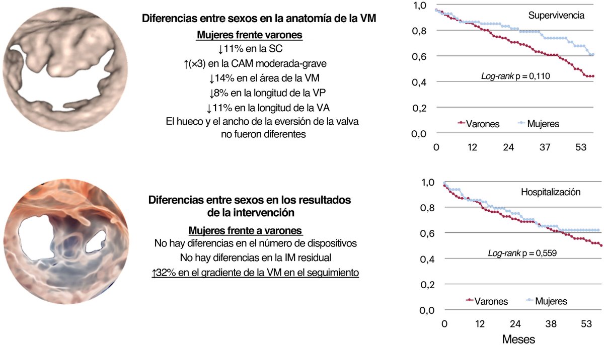 REC Publications (@revespcardiol) on Twitter photo Diferencias según el sexo en la anatomía de la insuficiencia mitral y resultados de la reparación percutánea de borde a borde #REC #AheadOfPrint @chpedroli <a href="/AsmaratsL/">Lluis Asmarats</a> <a href="/amassovr/">Albert Massó van Roessel</a> <a href="/EstefaniaFdezP3/">Estefania Fernandez Peregrina</a> <a href="/StructuralBCN/">Dabit Arzamendi</a> revespcardiol.org/es-diferencias… Diferencias según el sexo en la anatomía de la insuficiencia mitral y resultados de la reparación percutánea de borde a borde #REC #AheadOfPrint @chpedroli <a href="/AsmaratsL/">Lluis Asmarats</a> <a href="/amassovr/">Albert Massó van Roessel</a> <a href="/EstefaniaFdezP3/">Estefania Fernandez Peregrina</a> <a href="/StructuralBCN/">Dabit Arzamendi</a> revespcardiol.org/es-diferencias…