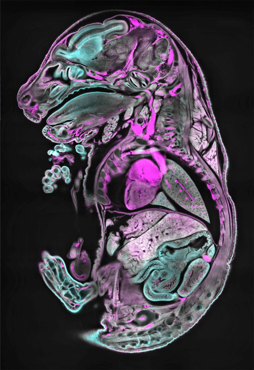 We’re excited to share amazing science our microscopes are enabling🔬  

From #3Dimaging  to developmental and cancer biology, spatial-omics and more!🧬🧠   

Follow us for cutting-edge discoveries at <a href="/embl/">EMBL</a>  <a href="/the_prbb/">Biomedicina BCN</a> and discover how #mesoscopic imaging can support your research