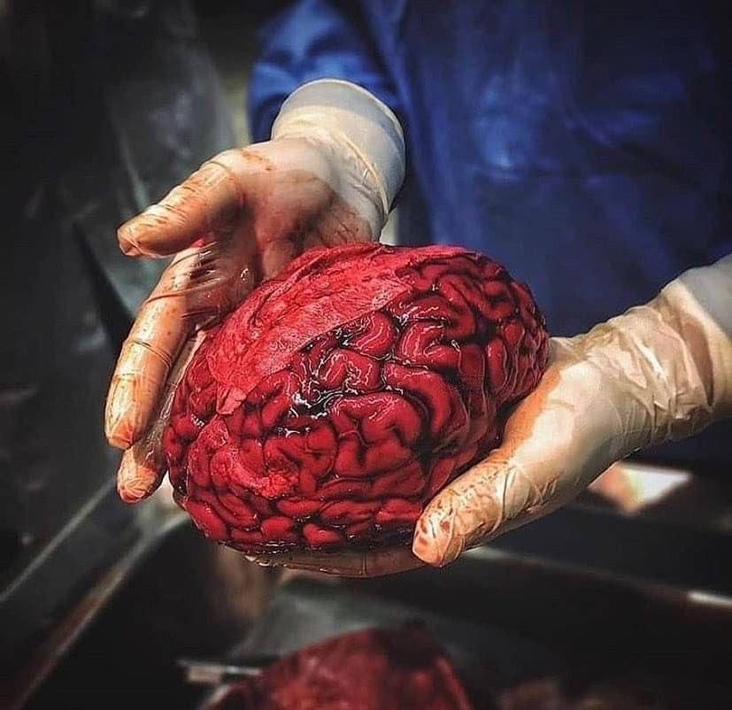 Smart1Doctor1's tweet image. Our brain 🧠
.
.
.
.
#Brain #Neuroscience #HumanBody #MentalHealth #Cognition #Neurology #Mind #BrainHealth #Science #Anatomy #Education #Wellness #Psychology #BrainPower #Curiosity