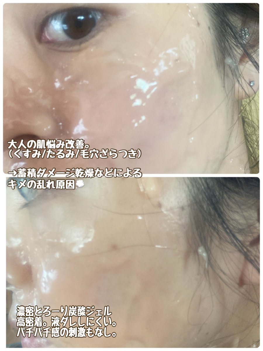 ohhhte's tweet photo. ＃乱れたキメにピタッとモニター CP👼🏻

【BYOUラスティング CO2イルミネイトジェルマスク】
1回分当選でしたがスタッフ様ご厚意で2回分いただきました。

＃ＰＲ
＃ラブコスメ
＃乱れたキメにピタッと 

ラブコスメの商品モニターに協力しています。

@staff_sakurai 櫻井様
@lcstaff  ラブコスメ https://t.co/Pa9z7C6494