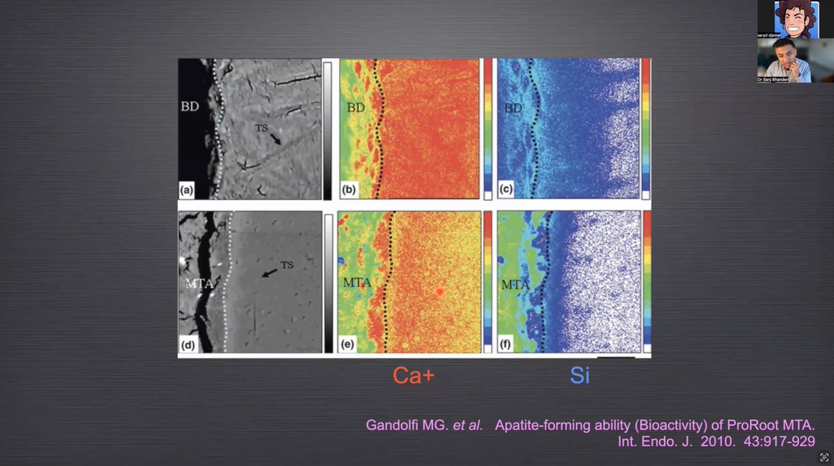 Last Tuesday was the start of our 2025 Bish Bash Bosh webinar series! 

Dr Sanjeev Bhanderi gave a fascinating lecture- the images below give a preview of the topics covered

If you missed it all BBB lectures are available to watch on demand for DTUK members!

#bishbashbosh