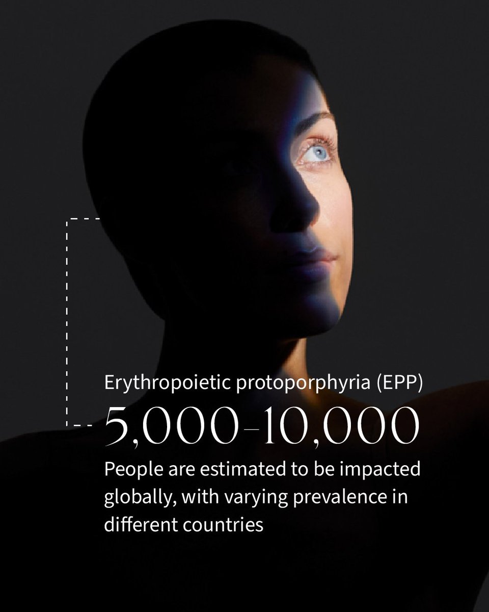 CLINUVEL (@clinuvelnews) on Twitter photo According to the American Porphyria Foundation (<a href="/Porphyria_Help/">American Porphyria Foundation</a>), the true prevalence of the family of #porphyrias remains unknown, but clinicians suggest that a range of 1 per 500–50,000 of population is probable.
Erythropoietic protoporphyria (#EPP) is estimated to impact According to the American Porphyria Foundation (<a href="/Porphyria_Help/">American Porphyria Foundation</a>), the true prevalence of the family of #porphyrias remains unknown, but clinicians suggest that a range of 1 per 500–50,000 of population is probable.
Erythropoietic protoporphyria (#EPP) is estimated to impact