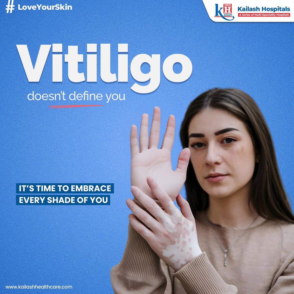 KailashHealth's tweet image. #Vitiligo is a common autoimmune skin disease leading skin to lose pigment or color. This condition should not fade the hope.

Seek expert care: kailashhealthcare.com

#skindisease #depigmentation #vitiligoawareness #dermatology