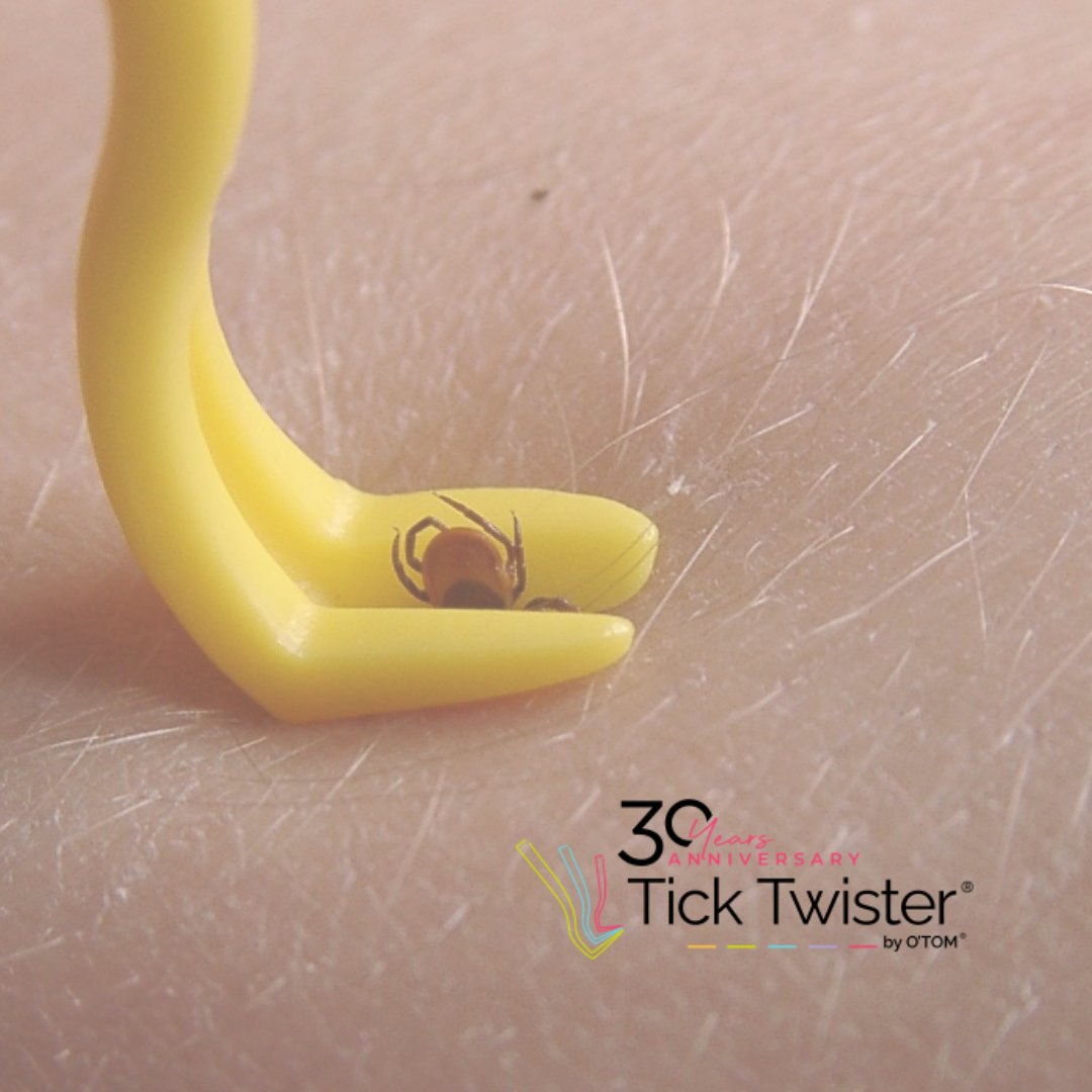 Lyme Disease UK (@uklyme) on Twitter photo 😳 Ticks are out in full force — are you ready?
This #LymeDiseaseAwarenessMonth, every <a href="/OtomTickTwister/">Tick Twister</a> bought via our site = 15% donated to Lyme Disease UK 💚
👉 lymediseaseuk.com/order-tick-twi…
#TickTwister #BeTickAware 😳 Ticks are out in full force — are you ready?
This #LymeDiseaseAwarenessMonth, every <a href="/OtomTickTwister/">Tick Twister</a> bought via our site = 15% donated to Lyme Disease UK 💚
👉 lymediseaseuk.com/order-tick-twi…
#TickTwister #BeTickAware