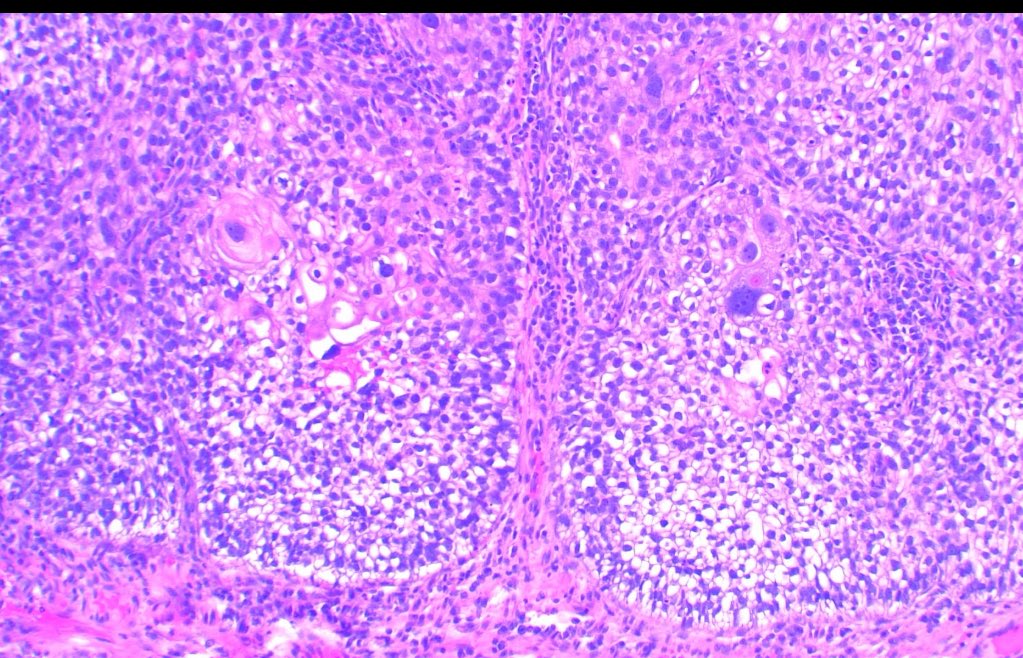 Jose Candido tweet media