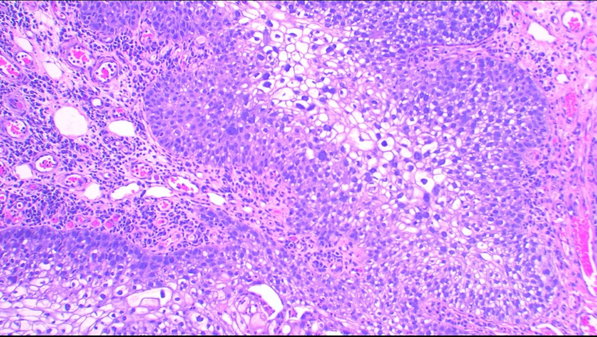 Jose Candido tweet media