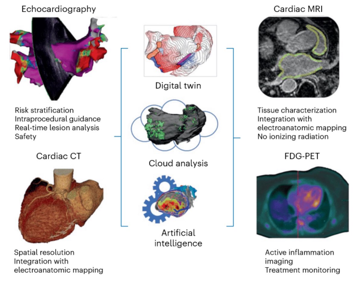 Elaine Wan (@elainewanmd) on Twitter photo 👉🏻Just published in <a href="/NatureCVR/">Nature Cardiovascular Research</a> most up to date review of “Cardiac Imaging Techniques for Electrophysiologists” - we cover everything CT/MRI/ICE/PET rdcu.be/elPtZ <a href="/ajrogers_md/">A.J. Rogers</a> <a href="/OlgaReyn/">Olga Reynbakh</a> <a href="/DJ_Lakkireddy/">DJ Lakkireddy</a> <a href="/drrakeshg1/">Rakesh Gopinath</a> <a href="/Hirad7/">Hirad Yarmohammadi</a> <a href="/NTrayanova/">NataliaTrayanova</a> <a href="/EP_mom1/">Mina Chung MD</a> #EPeeps #cardiotwitter 👉🏻Just published in <a href="/NatureCVR/">Nature Cardiovascular Research</a> most up to date review of “Cardiac Imaging Techniques for Electrophysiologists” - we cover everything CT/MRI/ICE/PET rdcu.be/elPtZ <a href="/ajrogers_md/">A.J. Rogers</a> <a href="/OlgaReyn/">Olga Reynbakh</a> <a href="/DJ_Lakkireddy/">DJ Lakkireddy</a> <a href="/drrakeshg1/">Rakesh Gopinath</a> <a href="/Hirad7/">Hirad Yarmohammadi</a> <a href="/NTrayanova/">NataliaTrayanova</a> <a href="/EP_mom1/">Mina Chung MD</a> #EPeeps #cardiotwitter
