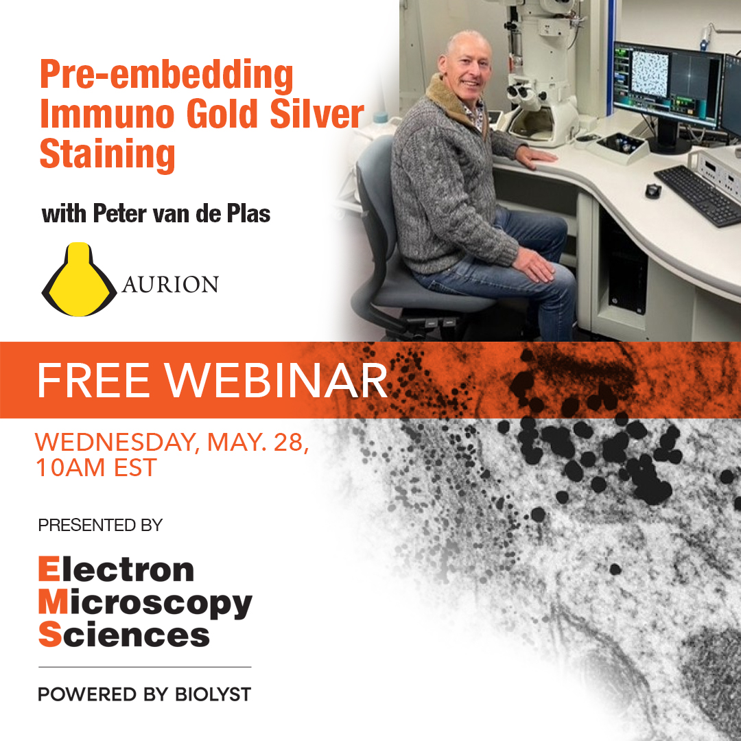 Don't miss this introduction to Pre-embedding Immuno Gold Silver Staining (IGSS).
Date: 5/28/25
Time: 10:00 AM (ET)
Speaker: Peter van de Plas
Learn more and register: bit.ly/44lDY2A
#EMShasit #microscopy #microtomy #Aurion #immunogold