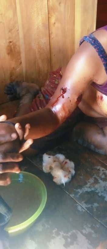 [GRAPHIC]

13/5/25 Intan Jaya, West Papua

Indonesian forces raided the villages of Ndugusiga, Jaindapa, and Sugapa Lama in the morning.

Known victims of the indiscriminate shootings are MJ (a child) and JZ (a young mother).

More details about other victims will follow.
