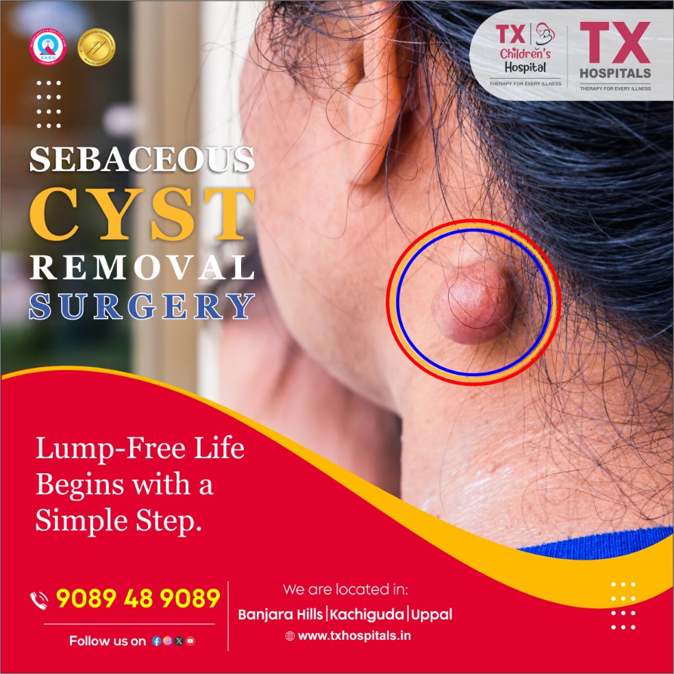 txhospitals's tweet photo. π΄ Sebaceous Cyst? Get It Out, Not Ignored.
Say goodbye to painful lumps and discomfort with a quick, safe procedure at TX Hospitals.
π Banjara Hills | Kachiguda | Uppal
π 9089 48 9089
π https://t.co/tMhkjDLQo9
#SebaceousCystRemoval #LumpFreeLife #TXHospitals https://t.co/CcS2kOFAHJ
